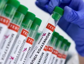 Rio de Janeiro confirma quinto caso de varíola dos macacos