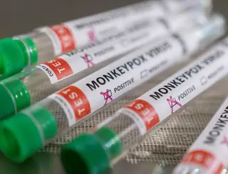 Anvisa recebe pedido de registro para teste de varíola dos macacos